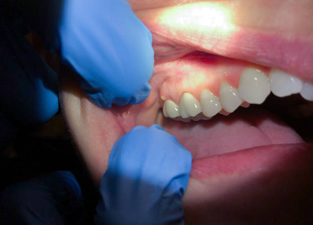 Best Pediatric Emergency Dentist in Wildewood, MD