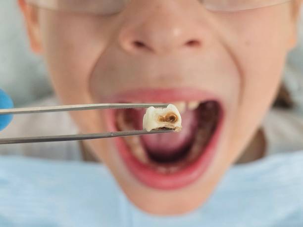 Best Emergency Treatment for Toothache in Wildewood, MD